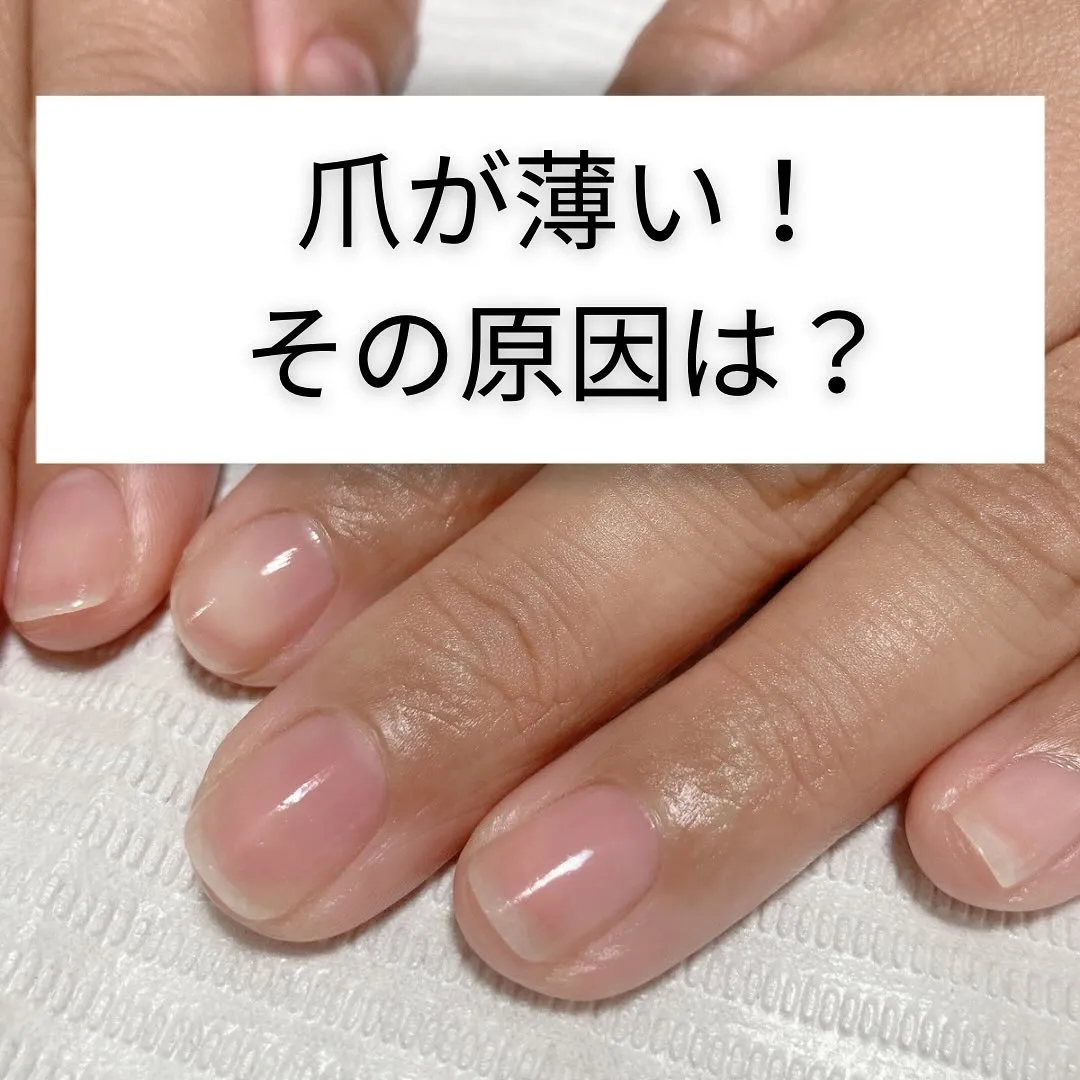 【爪が薄い！その原因は？】