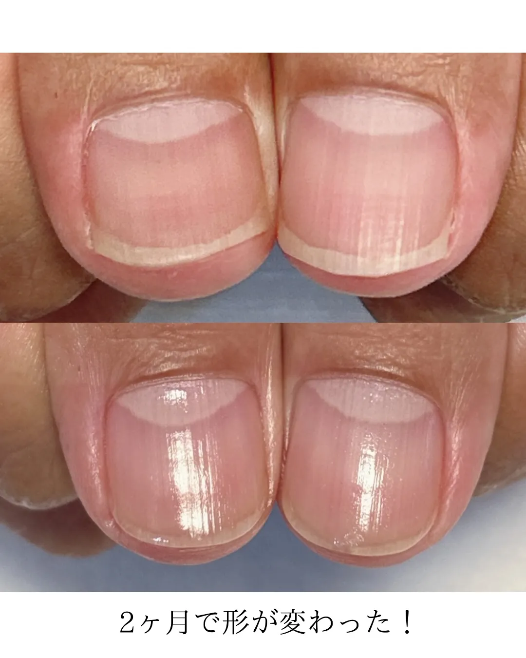 【ケアだけでここまで変わるんです!】