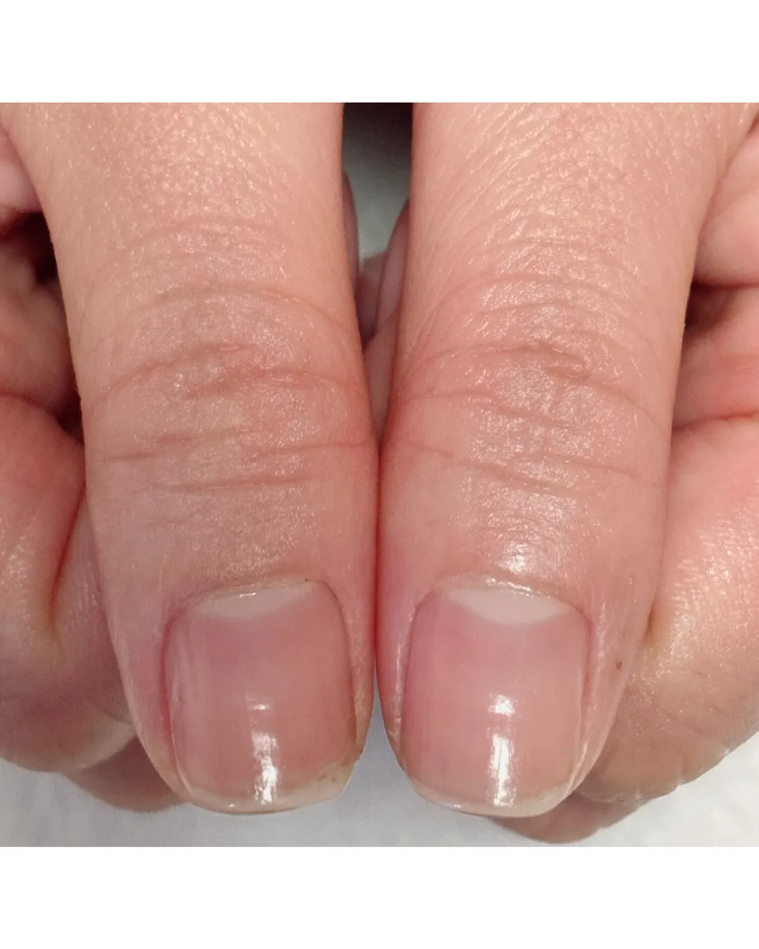 【自分ではできないケアで、変わる】