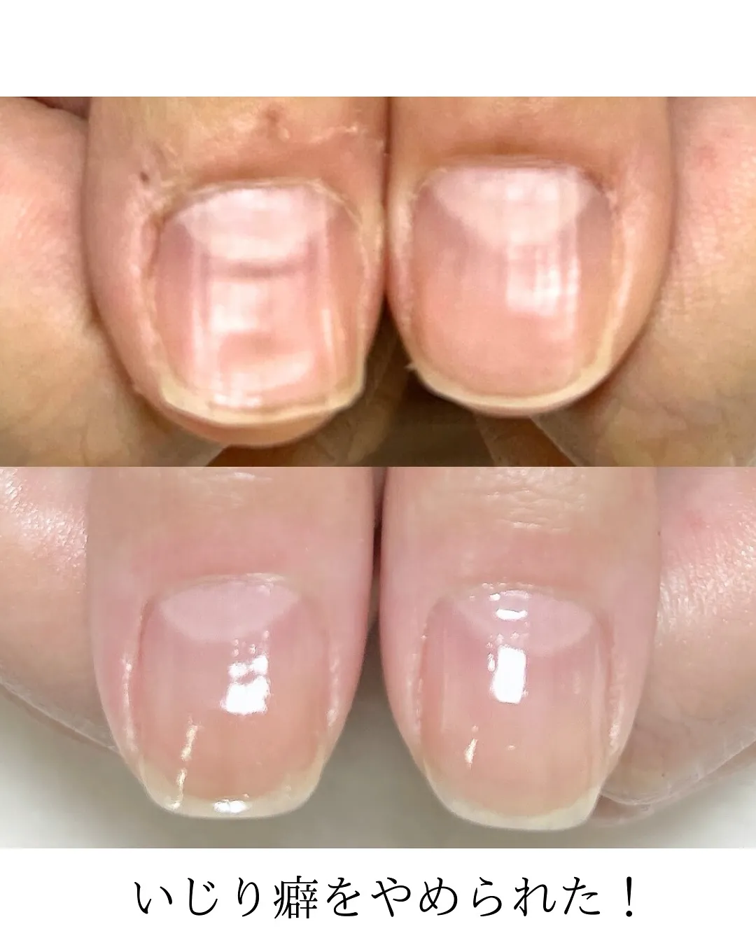 【一人ではやめられなかった癖が…】