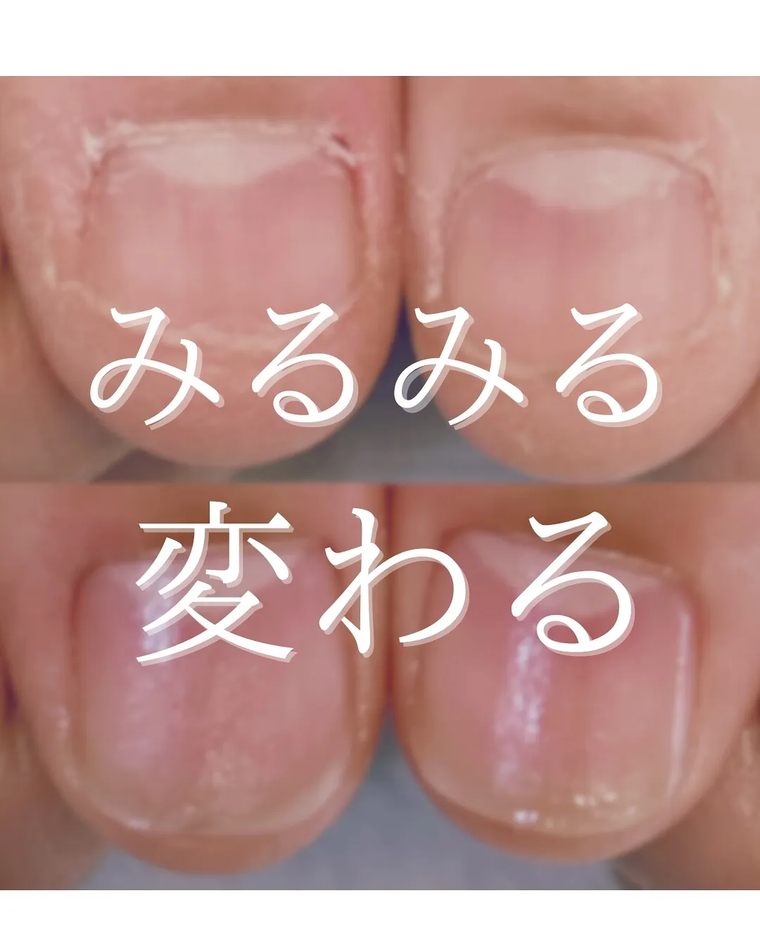 【ストレスがあるとつい…】