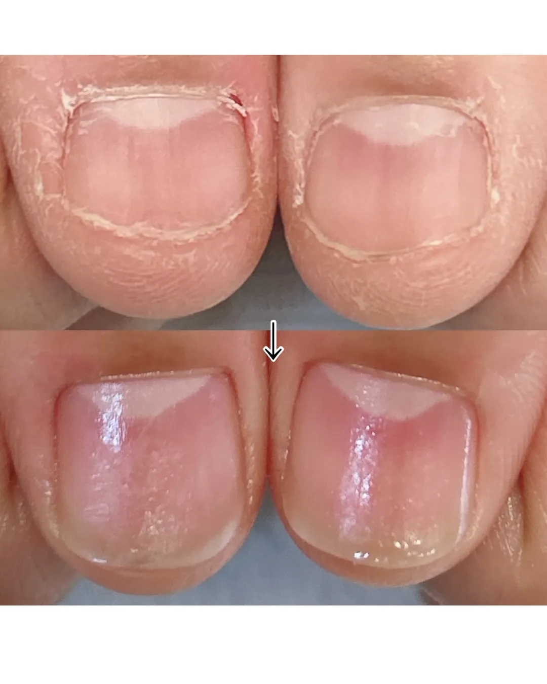 【ストレスがあるとつい…】