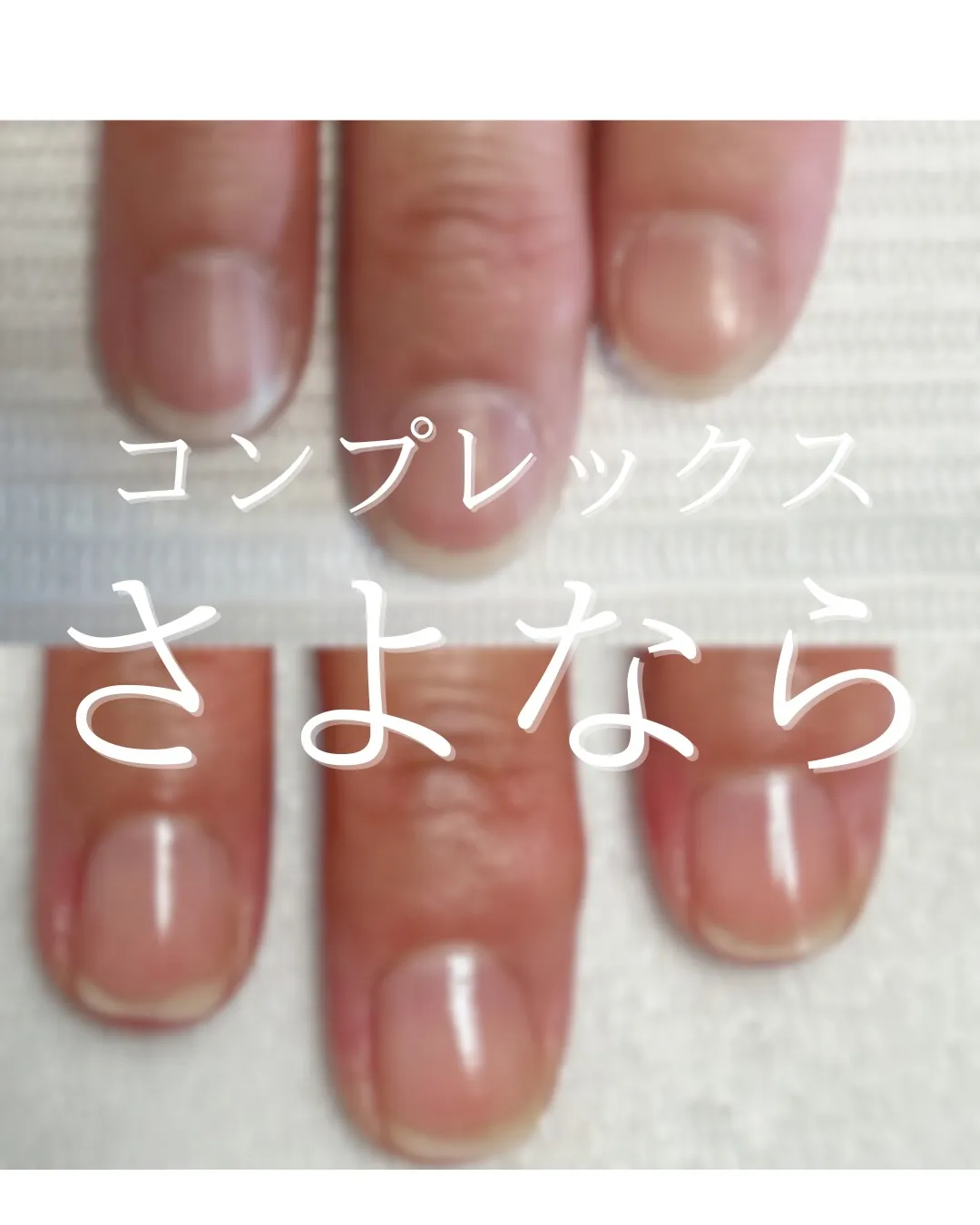 【コンプレックス、今日で終わりにしませんか？】