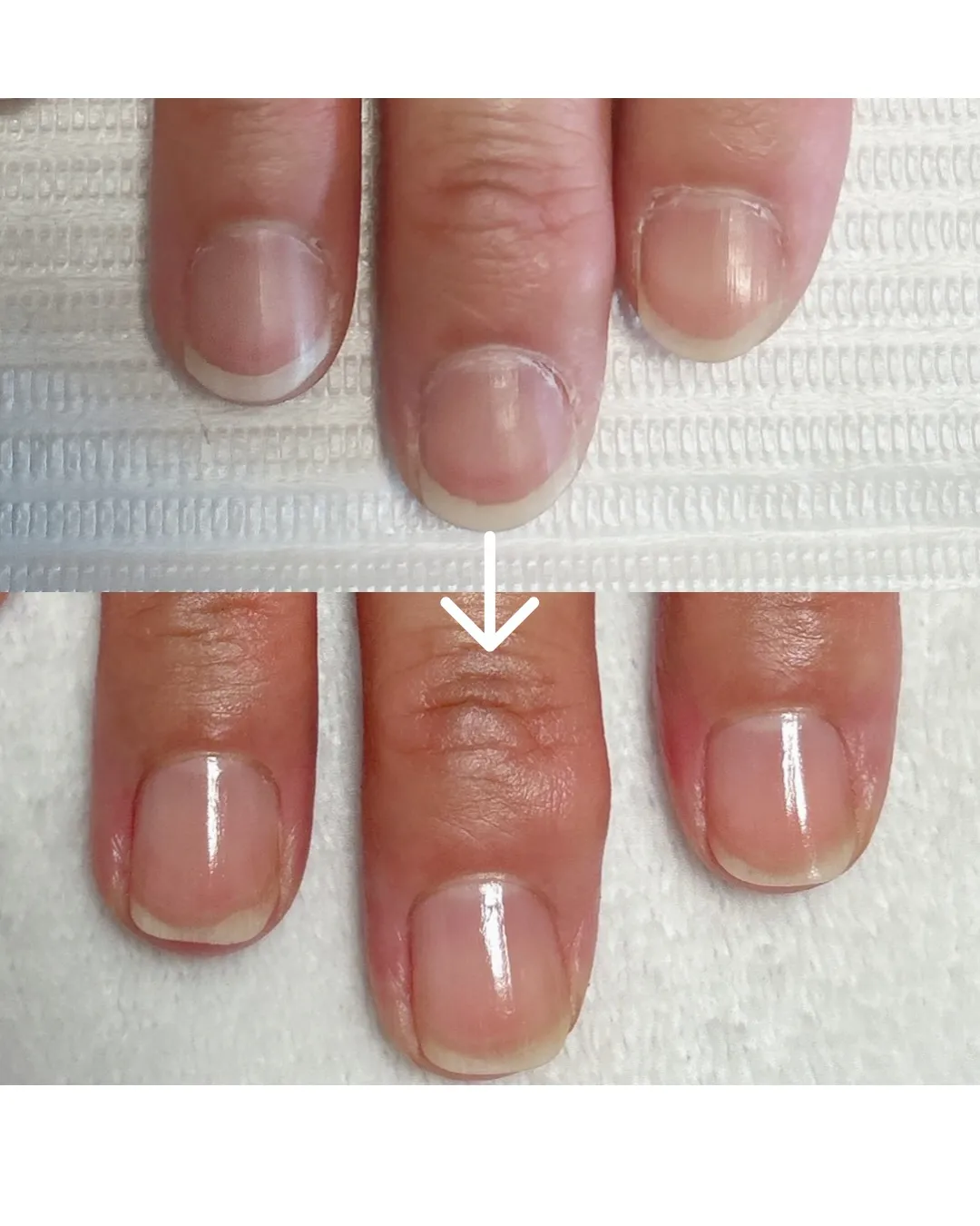 【コンプレックス、今日で終わりにしませんか？】