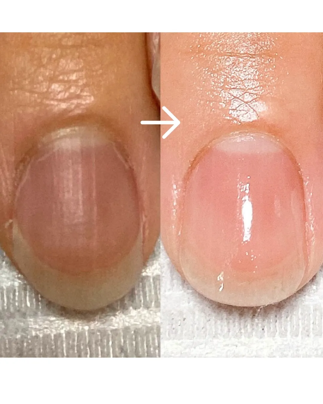 【爪の形って変えられるんですか？】