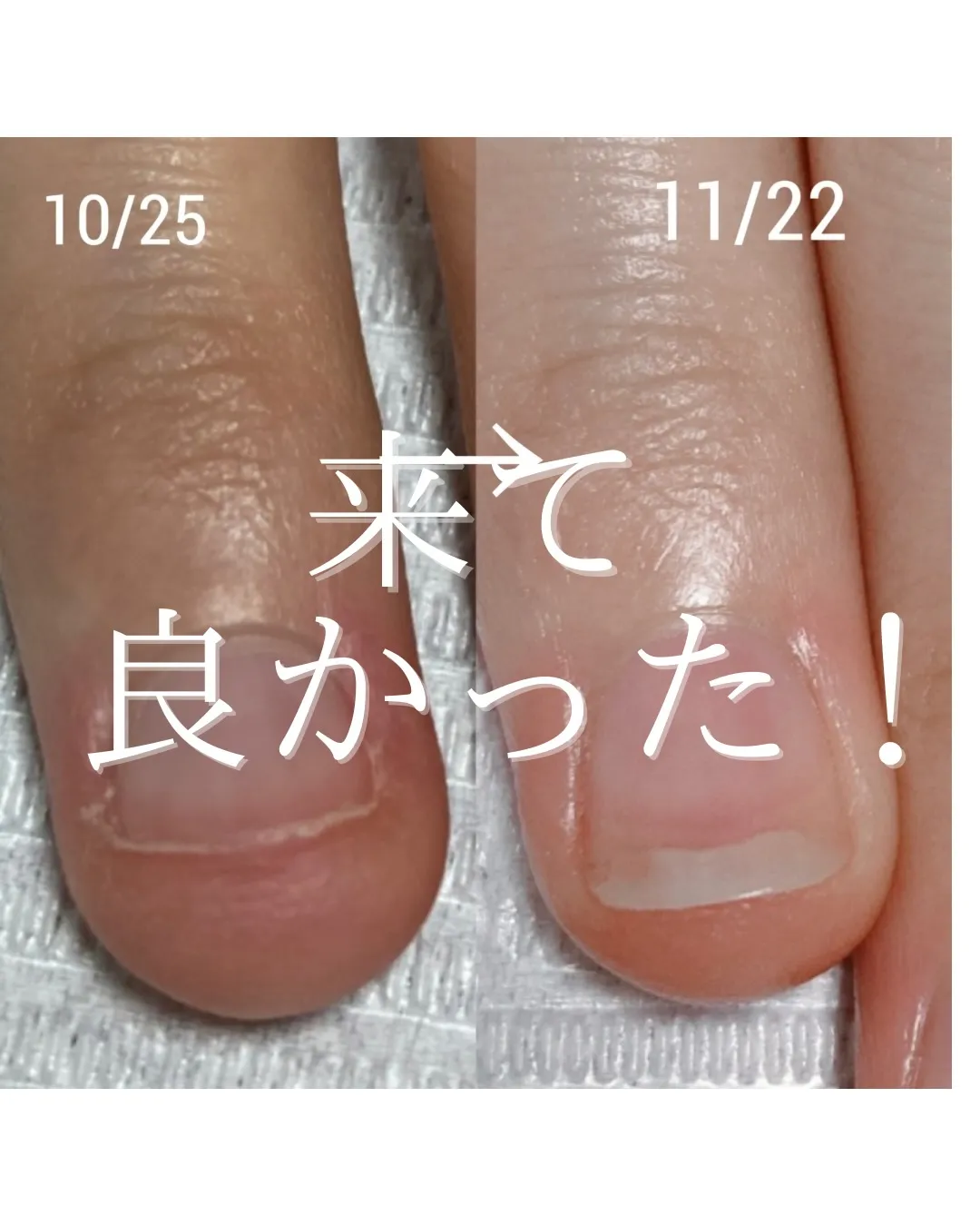 【私の爪、変わらないと思ってました】