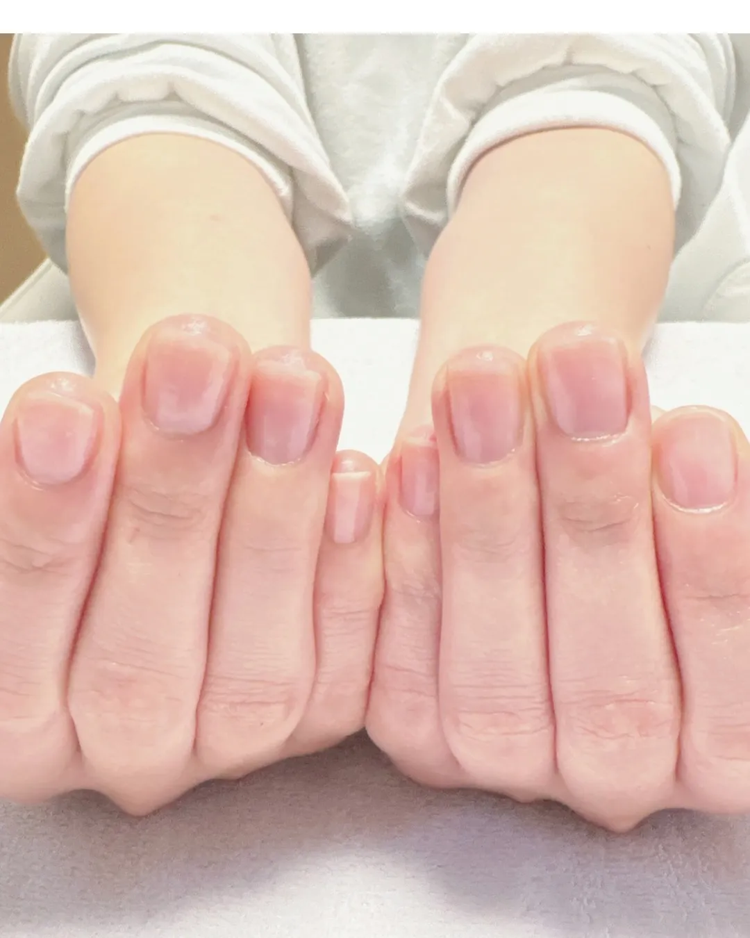 【爪は生まれつきだから…】