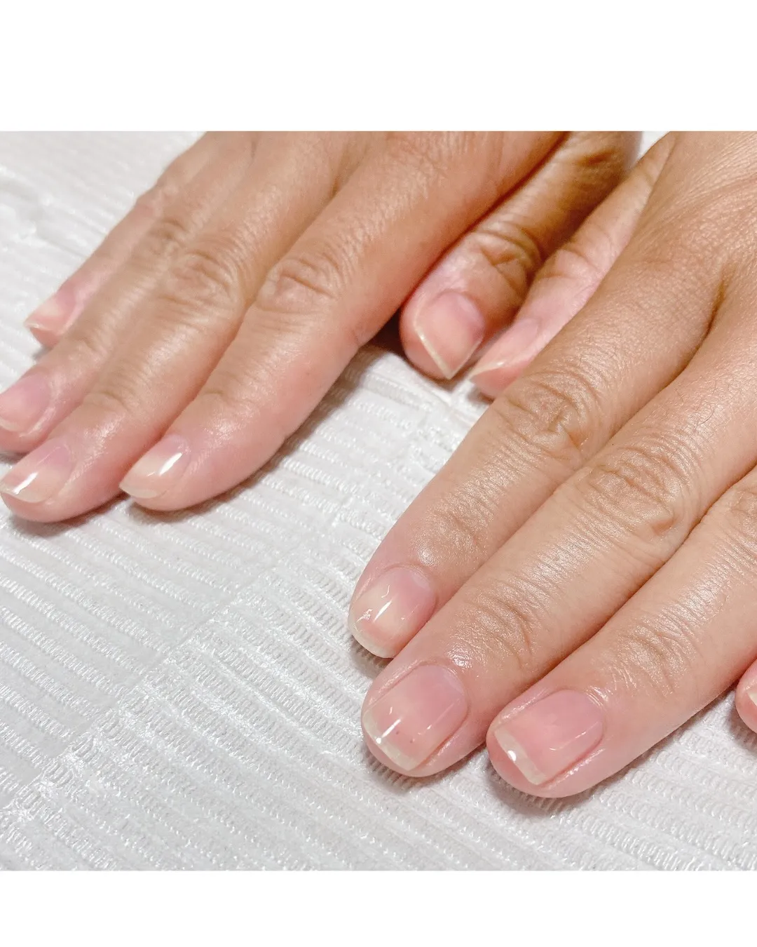 【自然で美しい自爪へ】