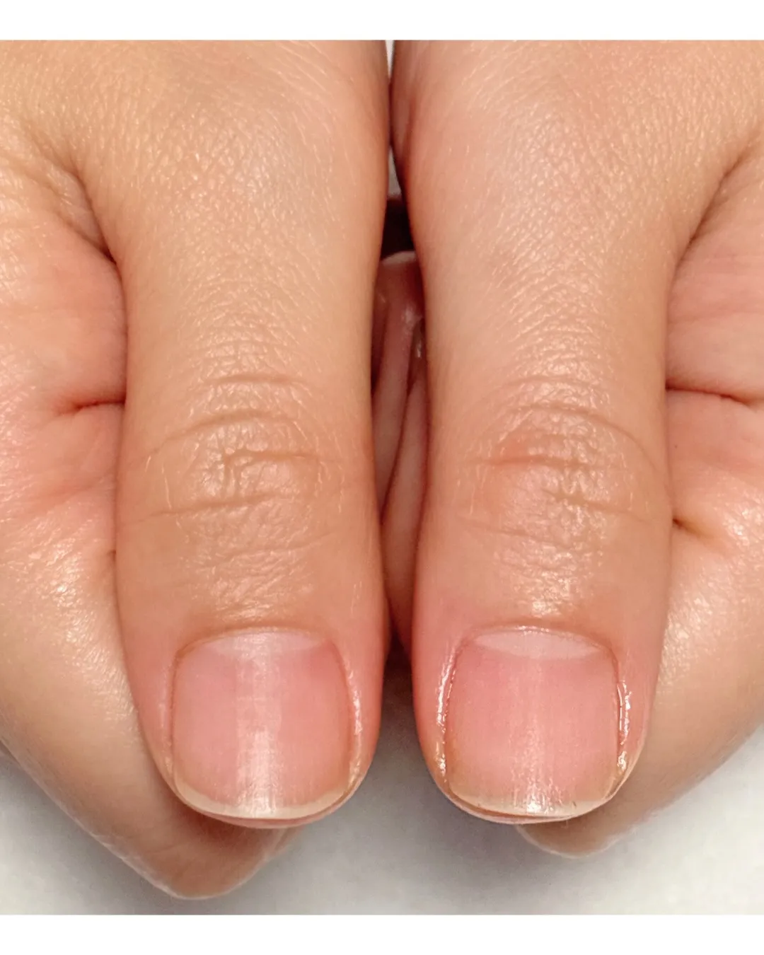 【自然で美しい自爪へ】