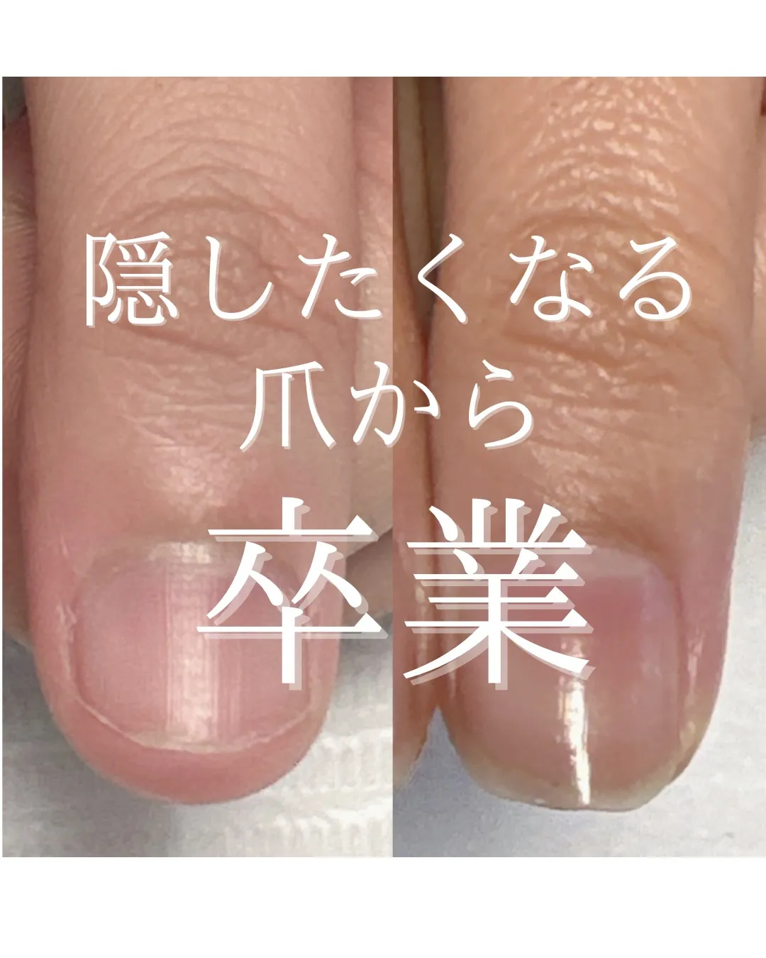 【続けた先の、この指先】